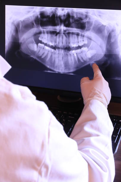 Best Emergency Dentist for Knocked-Out Tooth in Willard, UT
